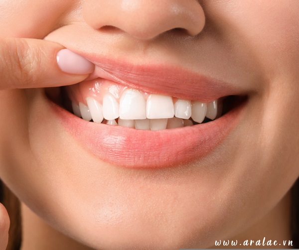 Nếu thường xuyên gặp vấn đề về răng miệng hãy coi chừng bạn đang bị thiếu hụt canxi
